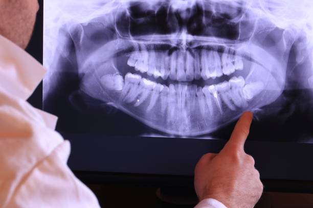 Best Urgent Dental Care for Toothache in Houston, MS