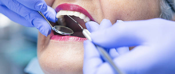 Best Emergency Dental Care for Abscessed Tooth in Houston, MS